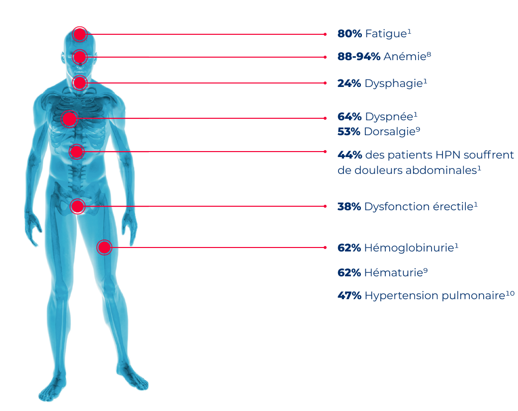 Image showing typical signs and symptons of PNH